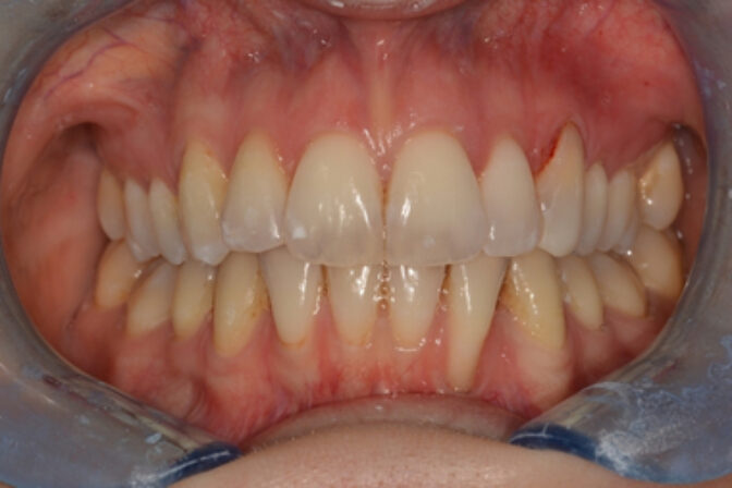 Orthodontics - Case 3 after