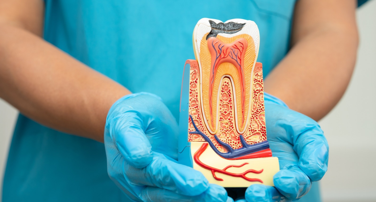 Root canal treatment to relieve pain and protect your smile