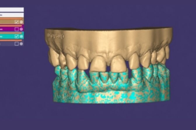 Digital Smile Design - Case 1 Digital before
