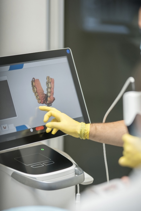 The benefits of digital dentures